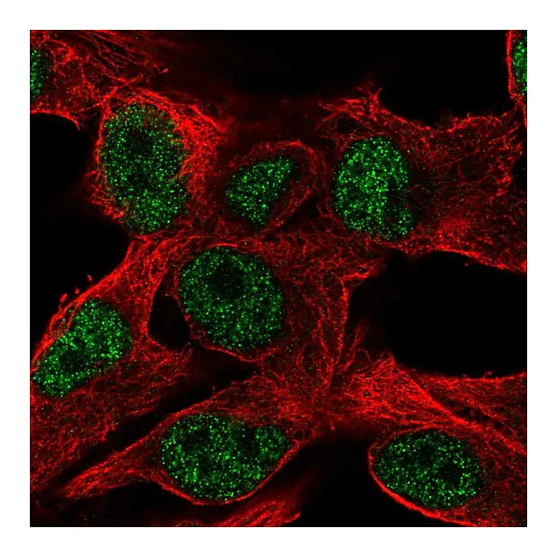 Atlas Antibodies Anti-PPP1R35 Antibody