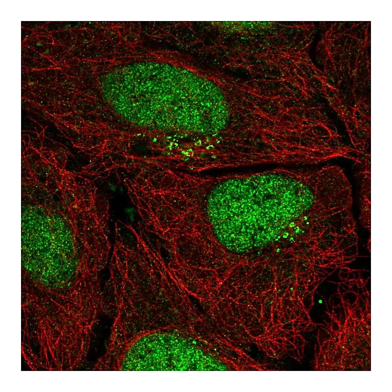 Atlas Antibodies Anti-PPP1R1C Antibody