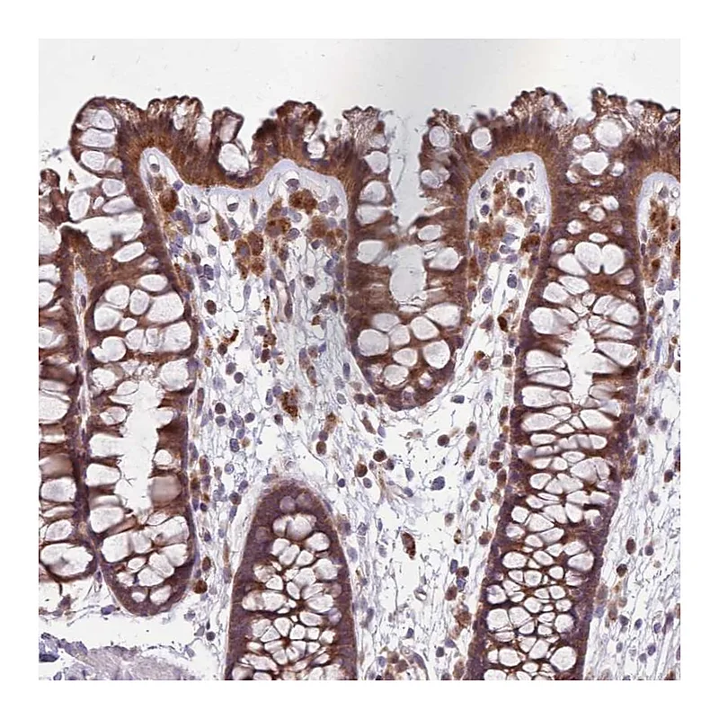 Atlas Antibodies Anti-PPP1R27 Antibody