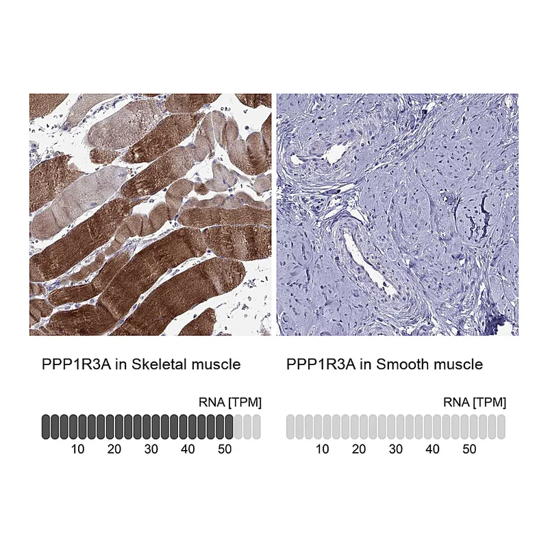 Atlas Antibodies Anti-PPP1R3A Antibody