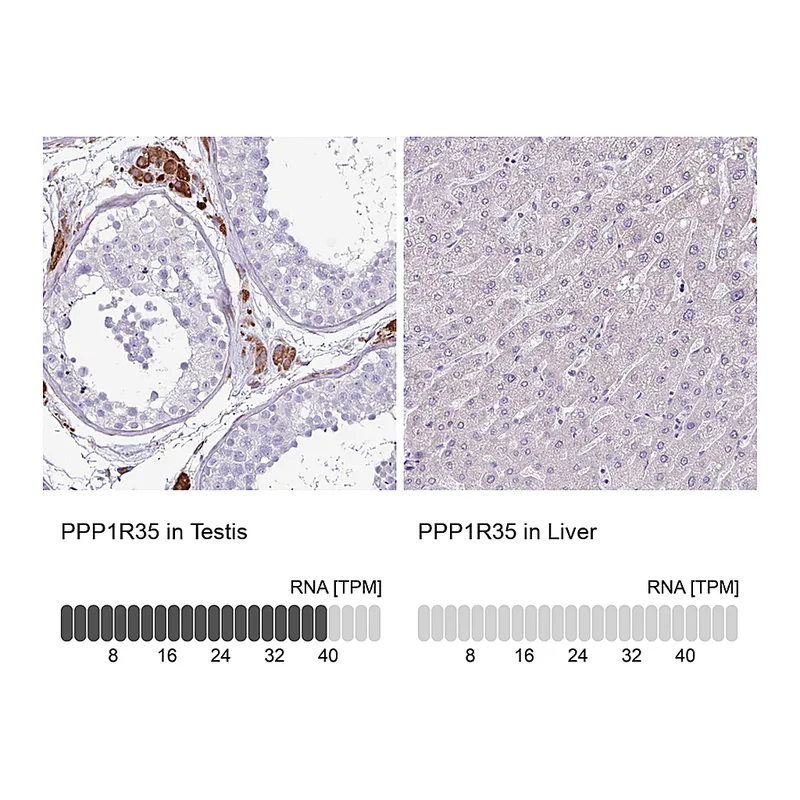 Atlas Antibodies Anti-PPP1R35 Antibody
