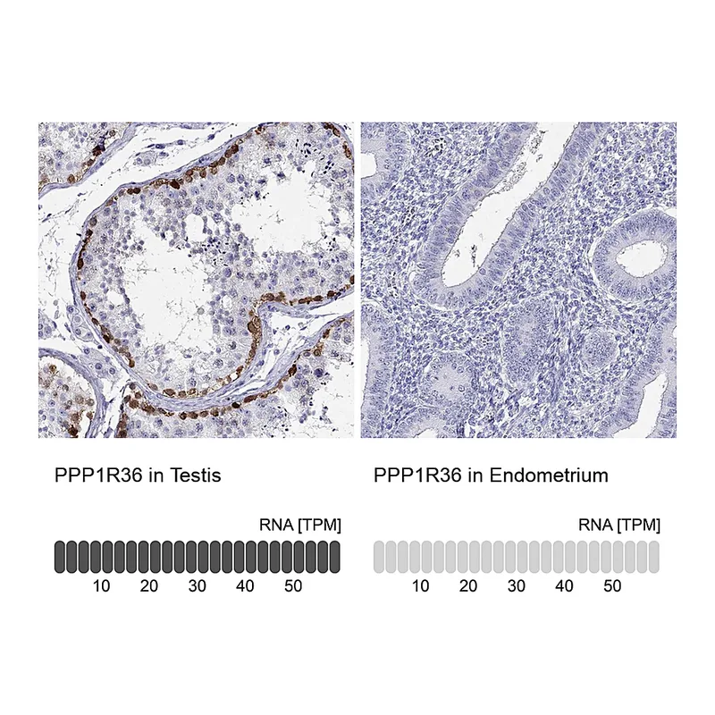 Atlas Antibodies Anti-PPP1R36 Antibody