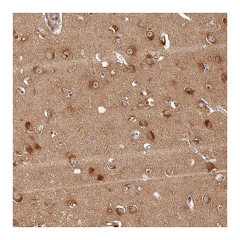 Atlas Antibodies Anti-PPP1R37 Antibody