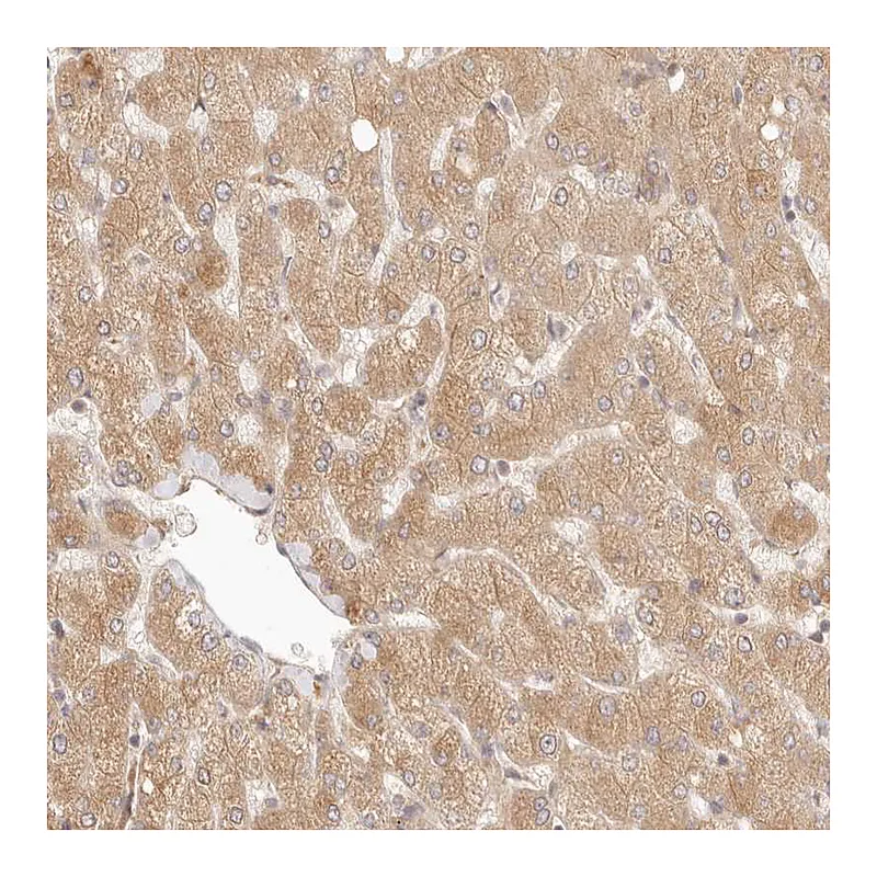 Atlas Antibodies Anti-PPP1R3B Antibody