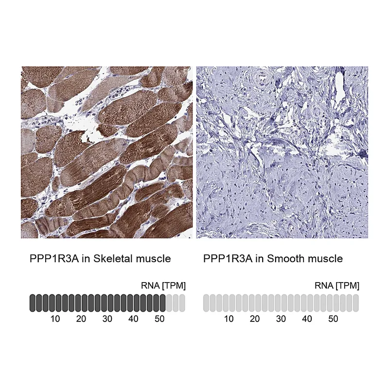 Atlas Antibodies Anti-PPP1R3A Antibody