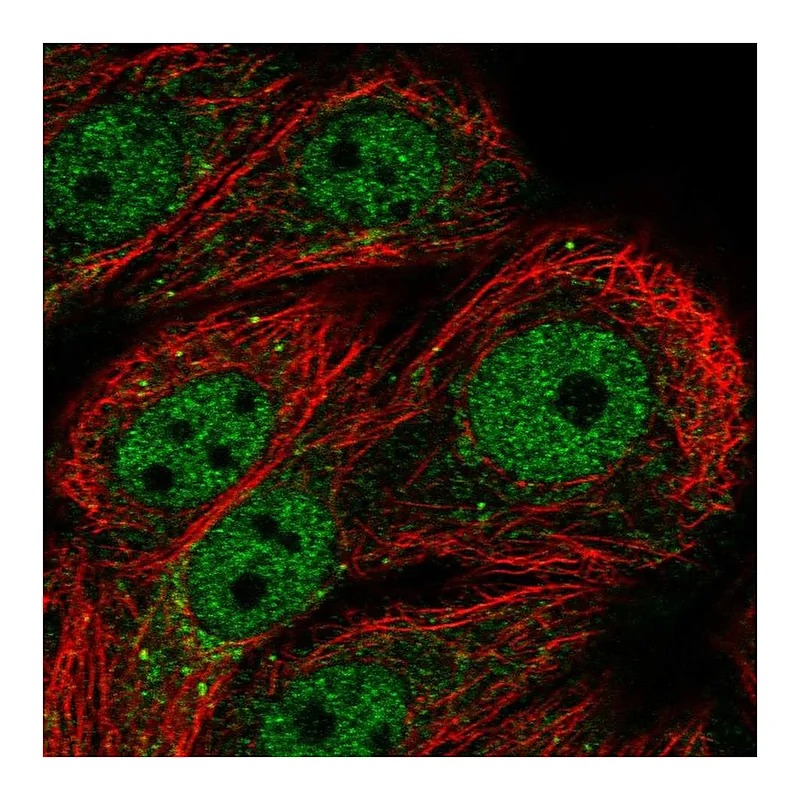 Atlas Antibodies Anti-PPP1R3F Antibody