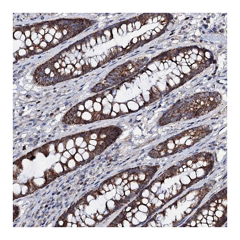 Atlas Antibodies Anti-PPP1R3D Antibody