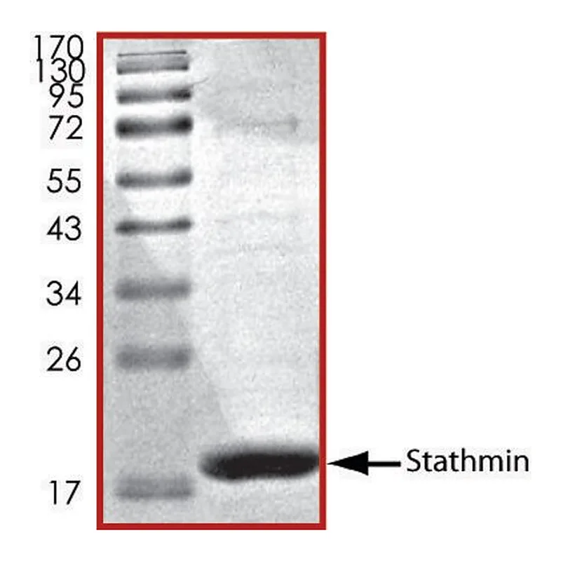 Merck Stathmin, His tagged human
