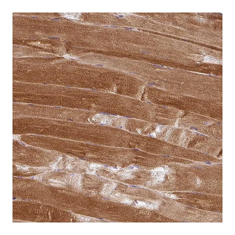 Atlas Antibodies Anti-PPP1R3G Antibody