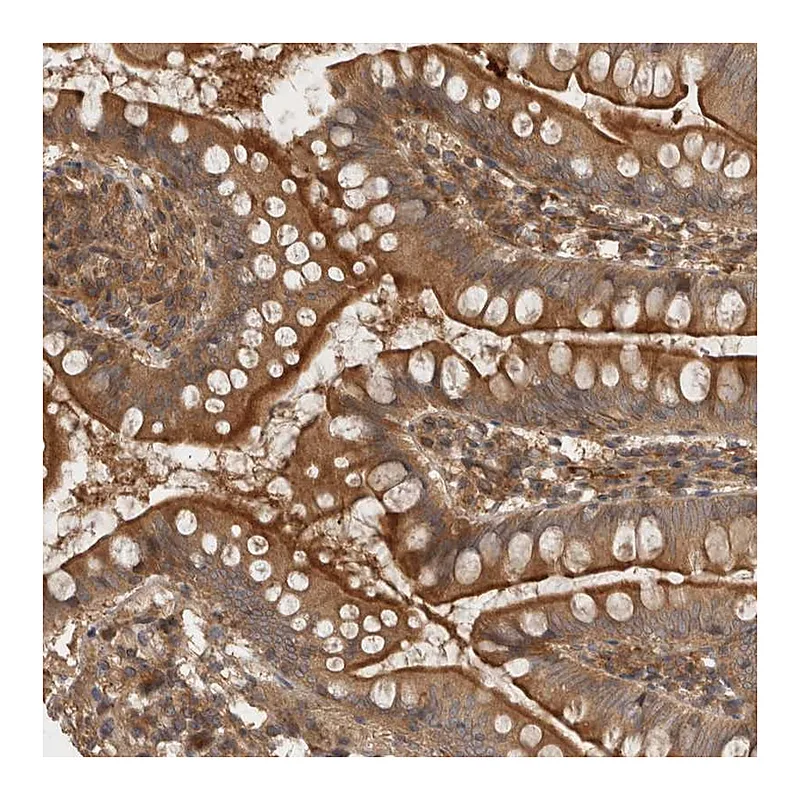 Atlas Antibodies Anti-PPP1R42 Antibody