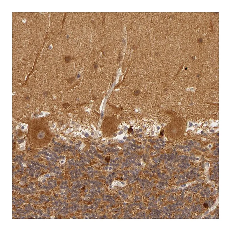 Atlas Antibodies Anti-PPP1R3F Antibody