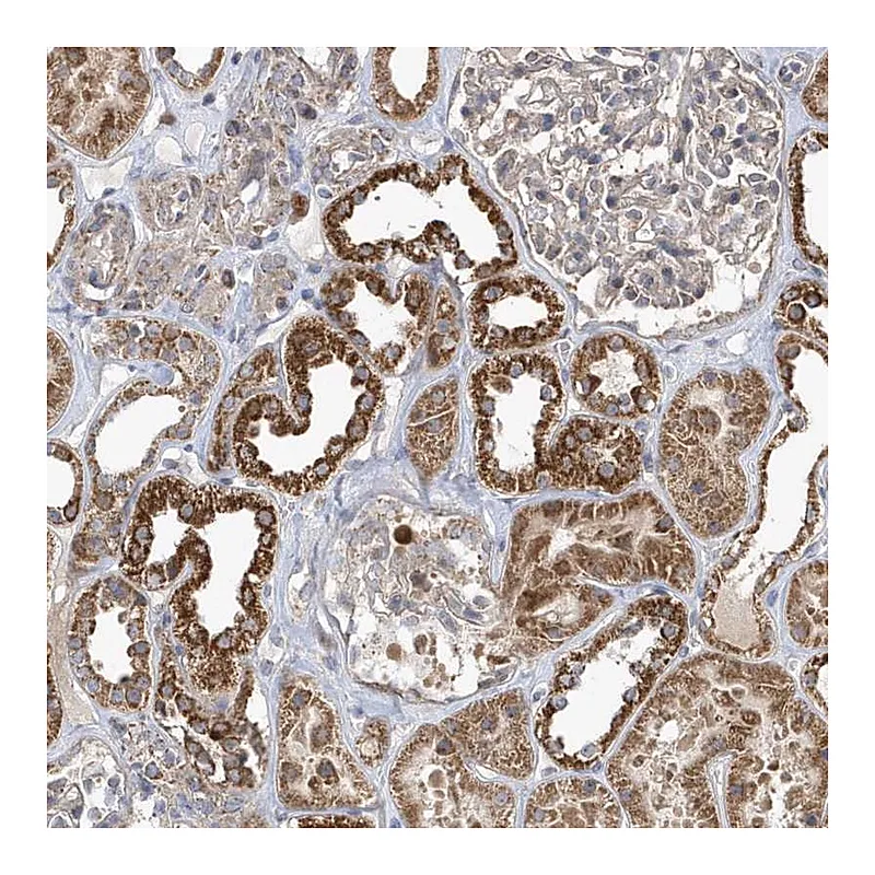 Atlas Antibodies Anti-PPP1R7 Antibody