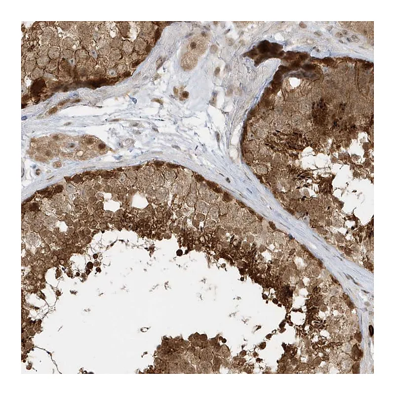 Atlas Antibodies Anti-PPP1R7 Antibody