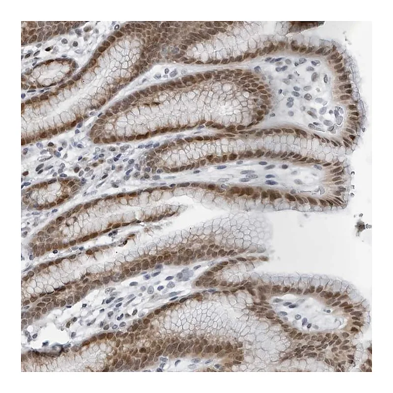 Atlas Antibodies Anti-PPP1R42 Antibody
