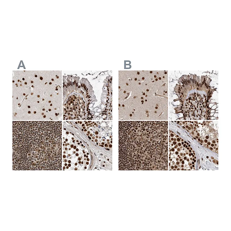 Atlas Antibodies Anti-PPP1R8 Antibody