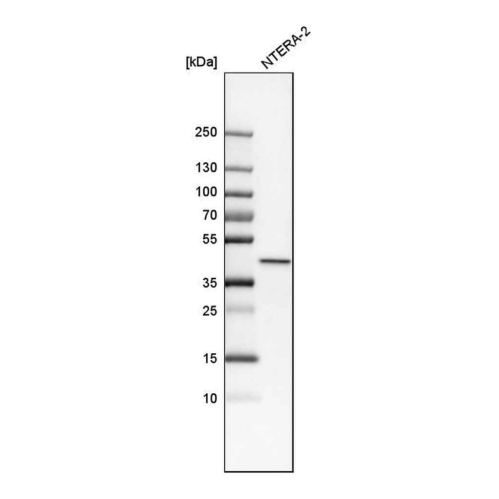 Atlas Antibodies Anti-PPP1R8 Antibody