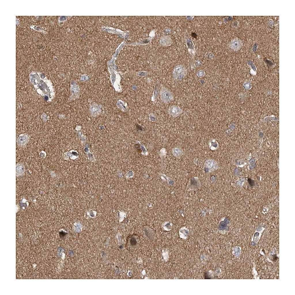 Atlas Antibodies Anti-PPP1R9A Antibody