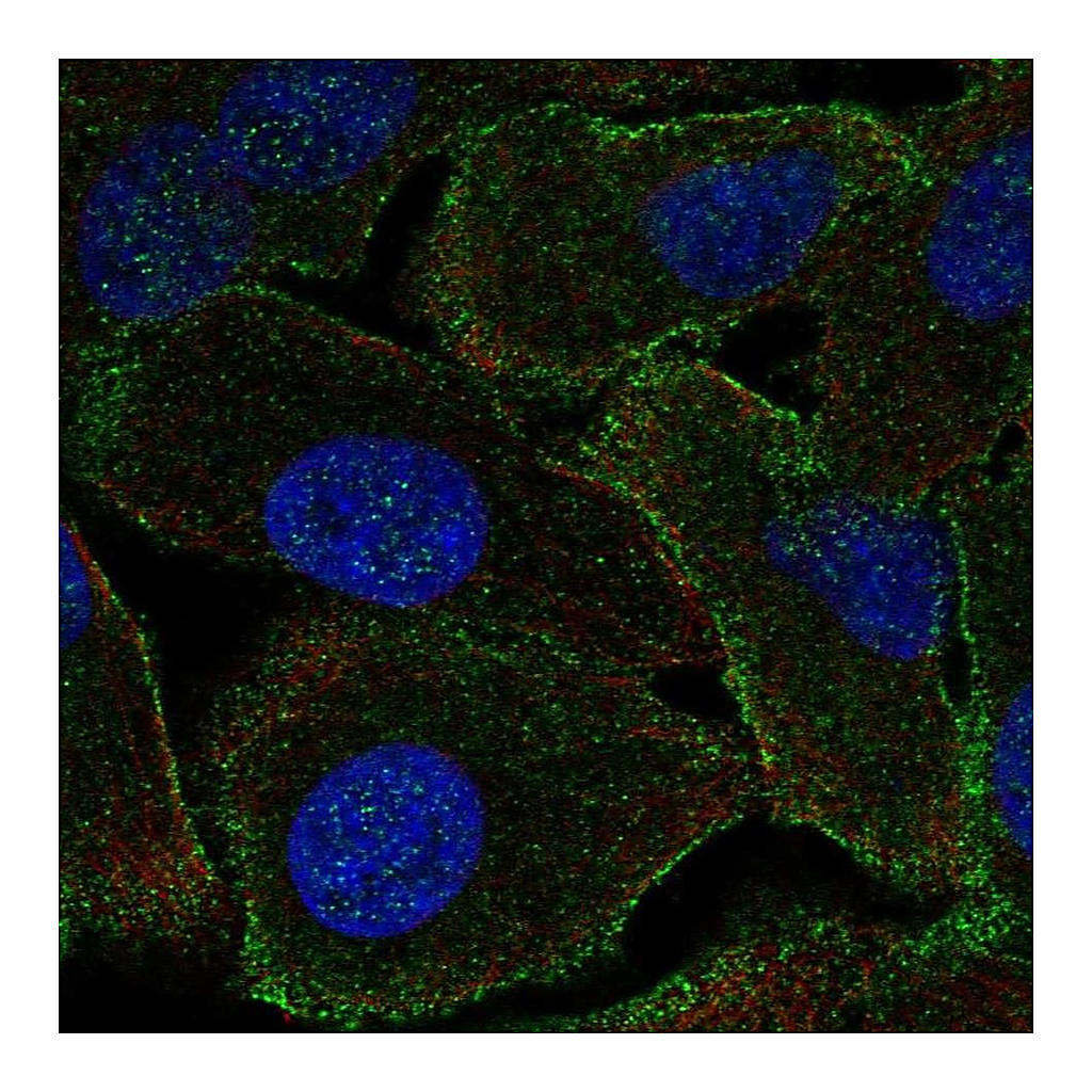 Atlas Antibodies Anti-PPP1R9A Antibody