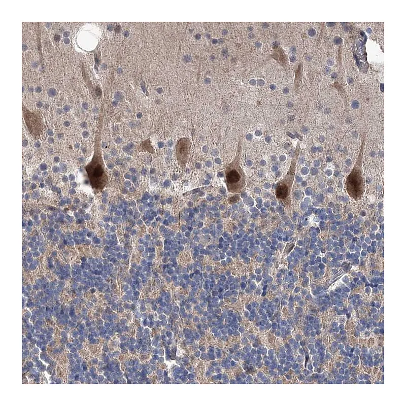 Atlas Antibodies Anti-PPP2R2B Antibody