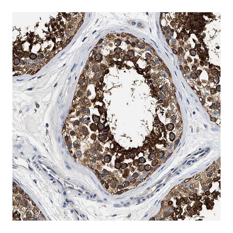 Atlas Antibodies Anti-PPP2R1B Antibody