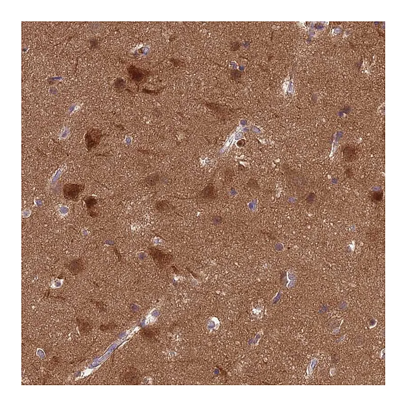 Atlas Antibodies Anti-PPP2CA Antibody