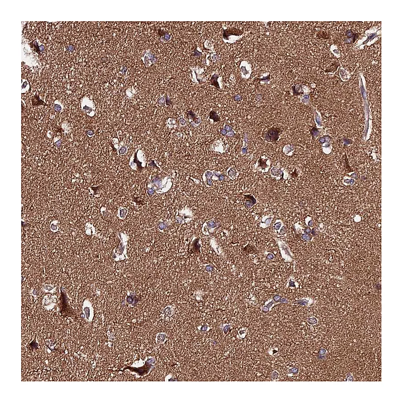 Atlas Antibodies Anti-PPP2R2B Antibody