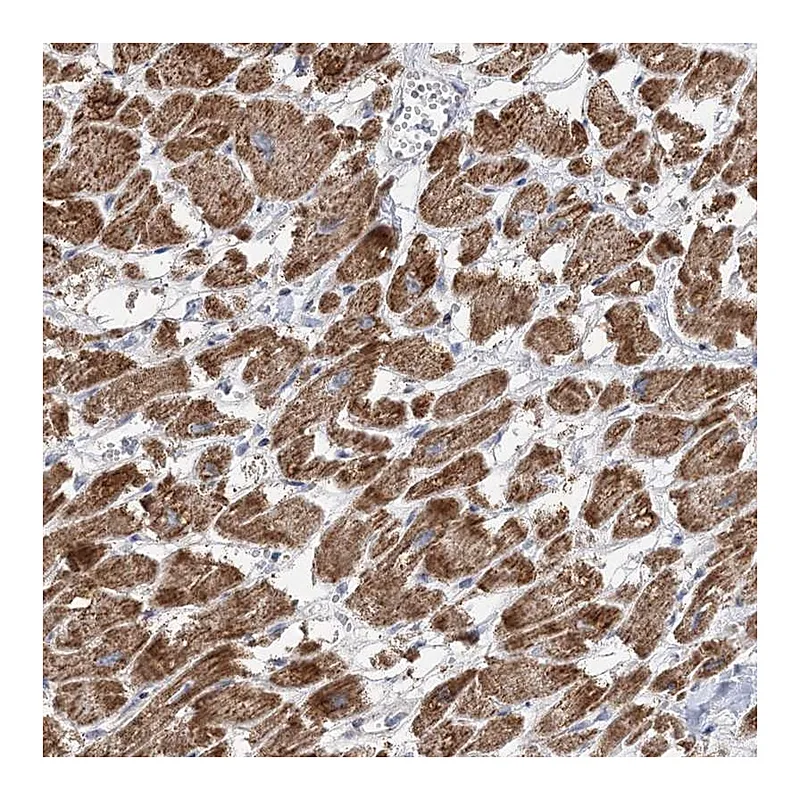 Atlas Antibodies Anti-PPP2R3A Antibody