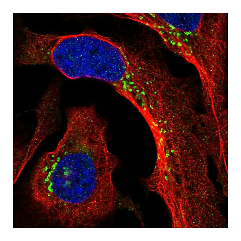 Atlas Antibodies Anti-PPP2R3A Antibody