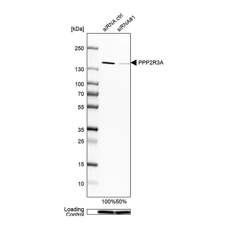 Atlas Antibodies Anti-PPP2R3A Antibody