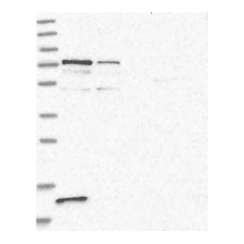 Atlas Antibodies Anti-PPP2R3B Antibody