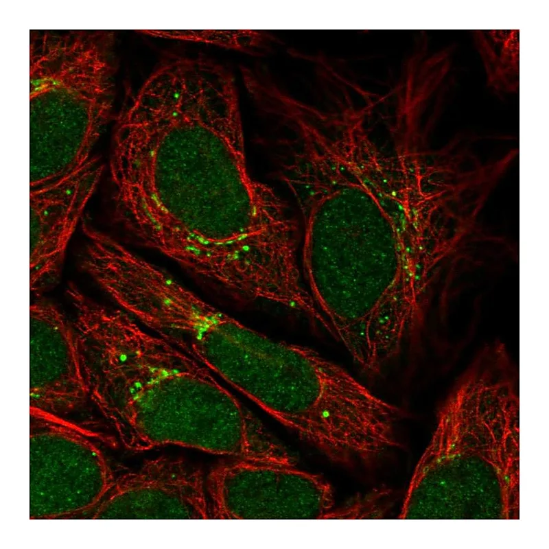 Atlas Antibodies Anti-PPP2R3C Antibody