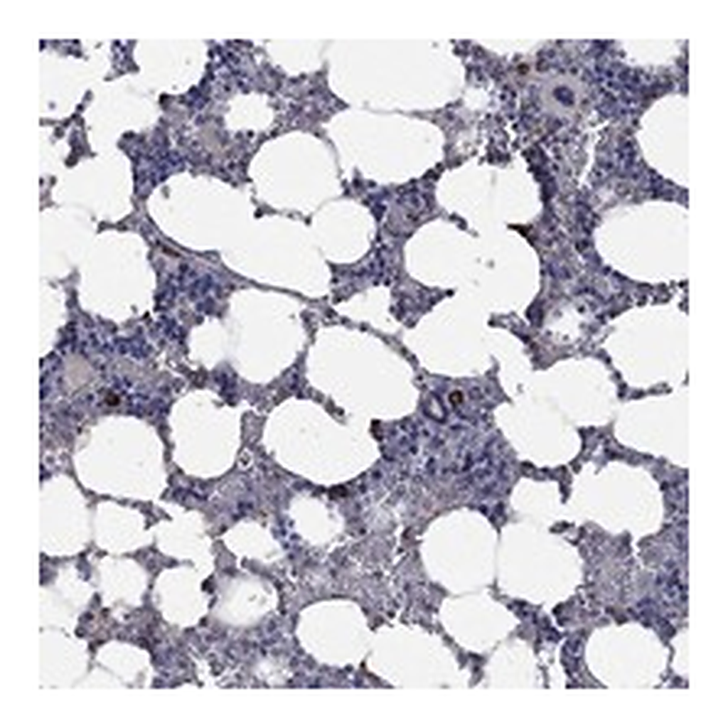Atlas Antibodies Anti-PPP2R5A Antibody