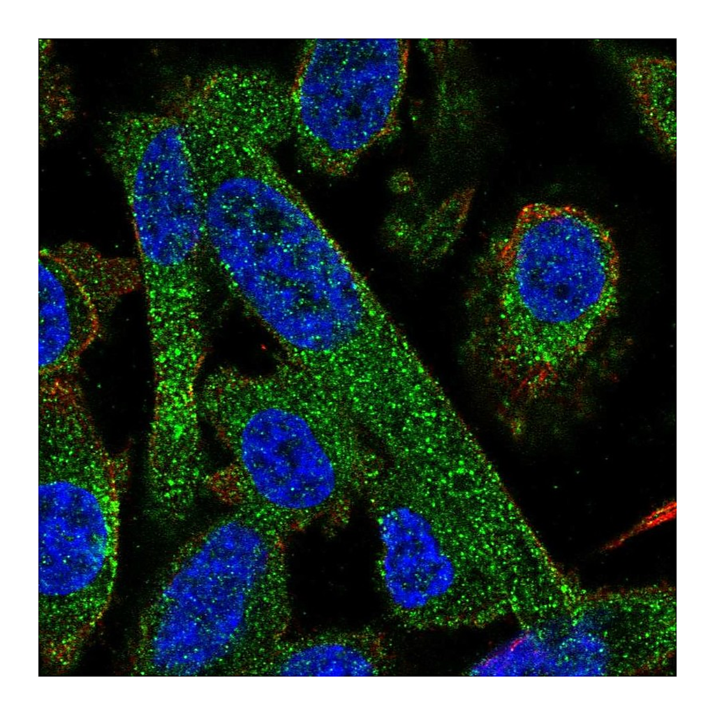 Atlas Antibodies Anti-PPP2R5A Antibody