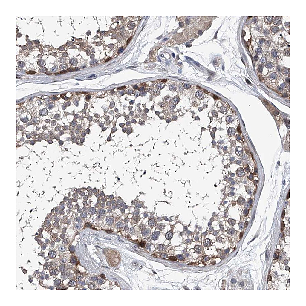Atlas Antibodies Anti-PPP2R5D Antibody