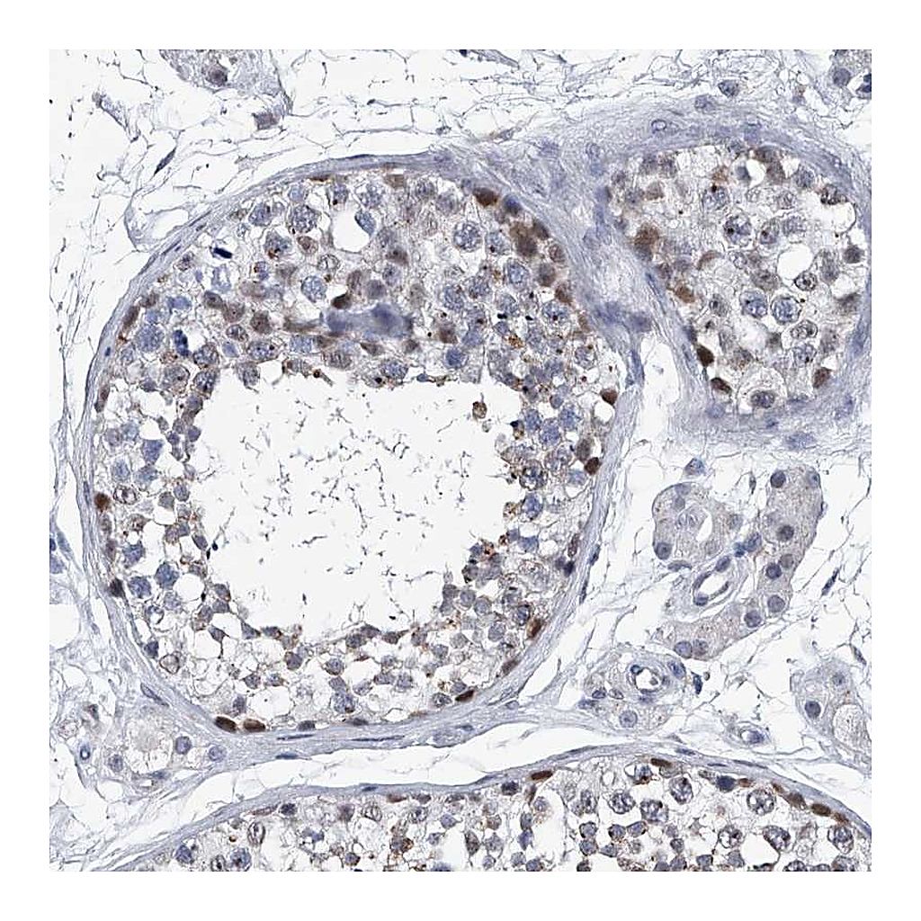 Atlas Antibodies Anti-PPP2R5D Antibody