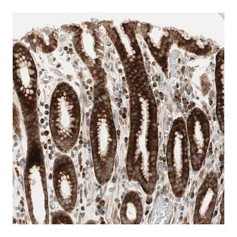 Atlas Antibodies Anti-PPP2R5E Antibody