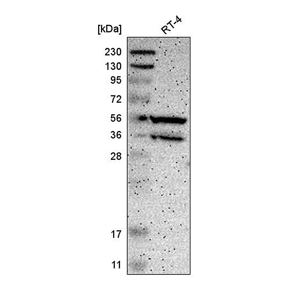 Atlas Antibodies Anti-PPP3CB Antibody