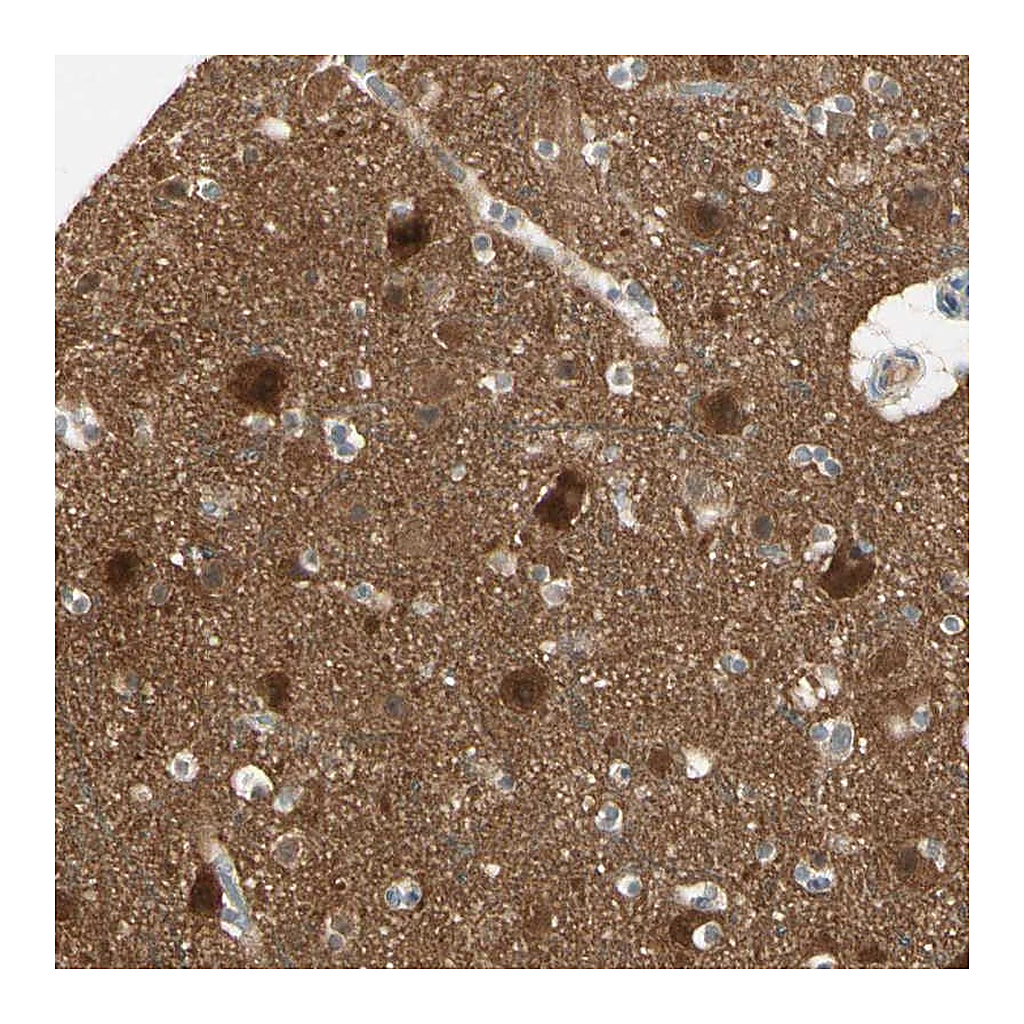 Atlas Antibodies Anti-PPP3CB Antibody