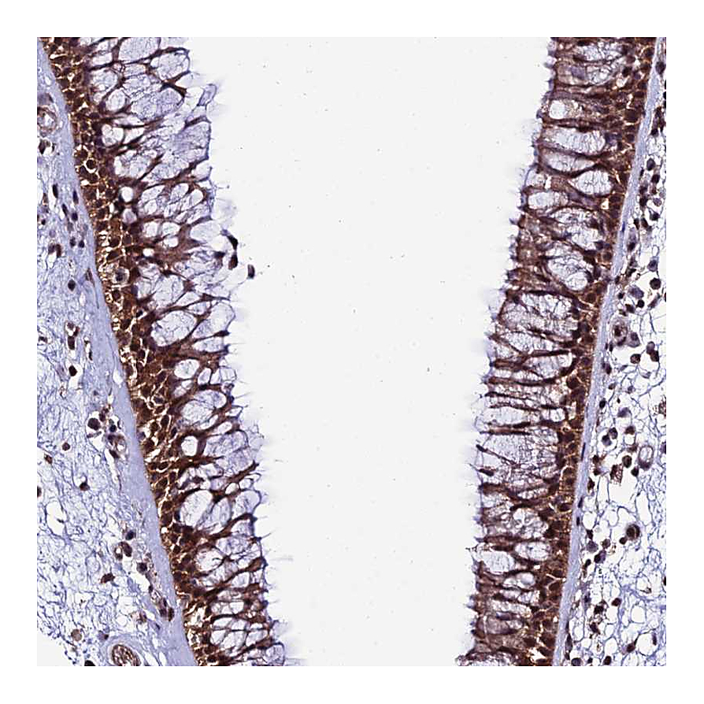 Atlas Antibodies Anti-PPP4C Antibody