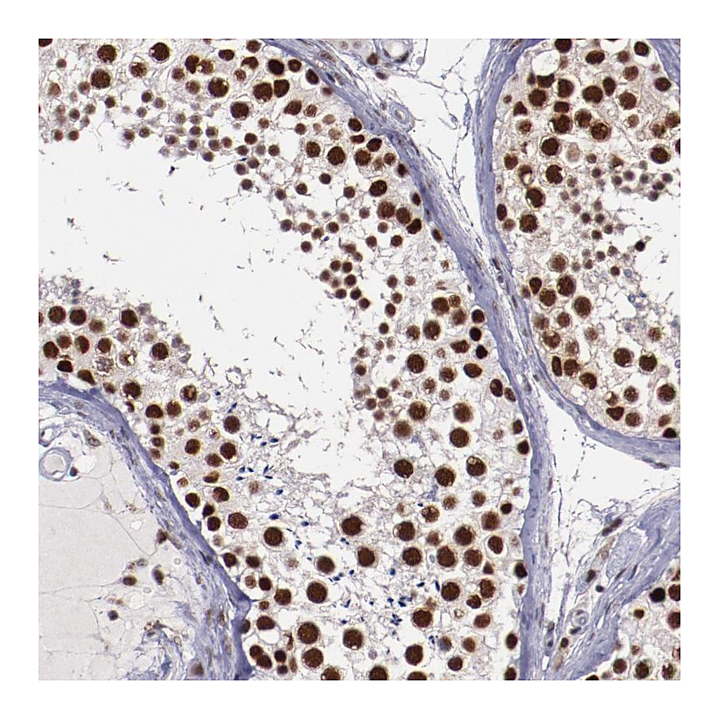 Atlas Antibodies Anti-PPP4R3A Antibody