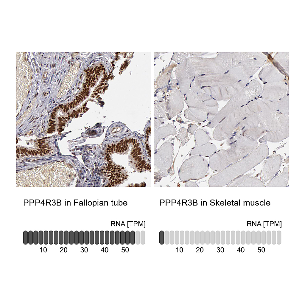 Atlas Antibodies Anti-PPP4R3B Antibody