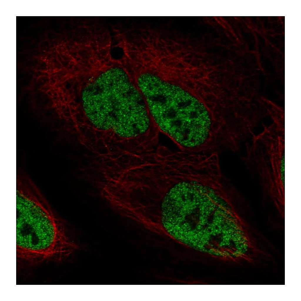 Atlas Antibodies Anti-PPP4R2 Antibody