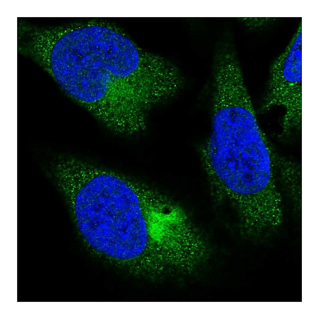 Atlas Antibodies Anti-PPP4R4 Antibody