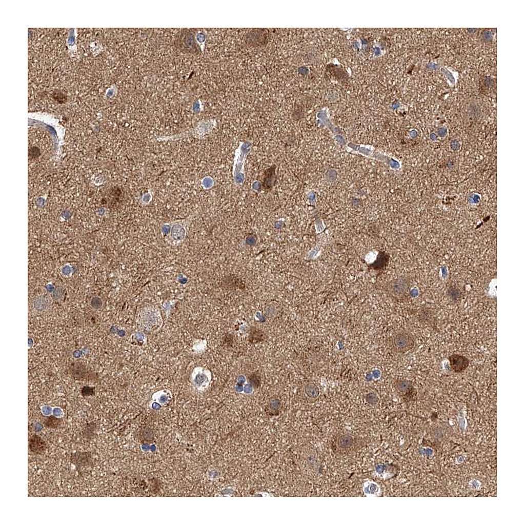 Atlas Antibodies Anti-PPP5C Antibody