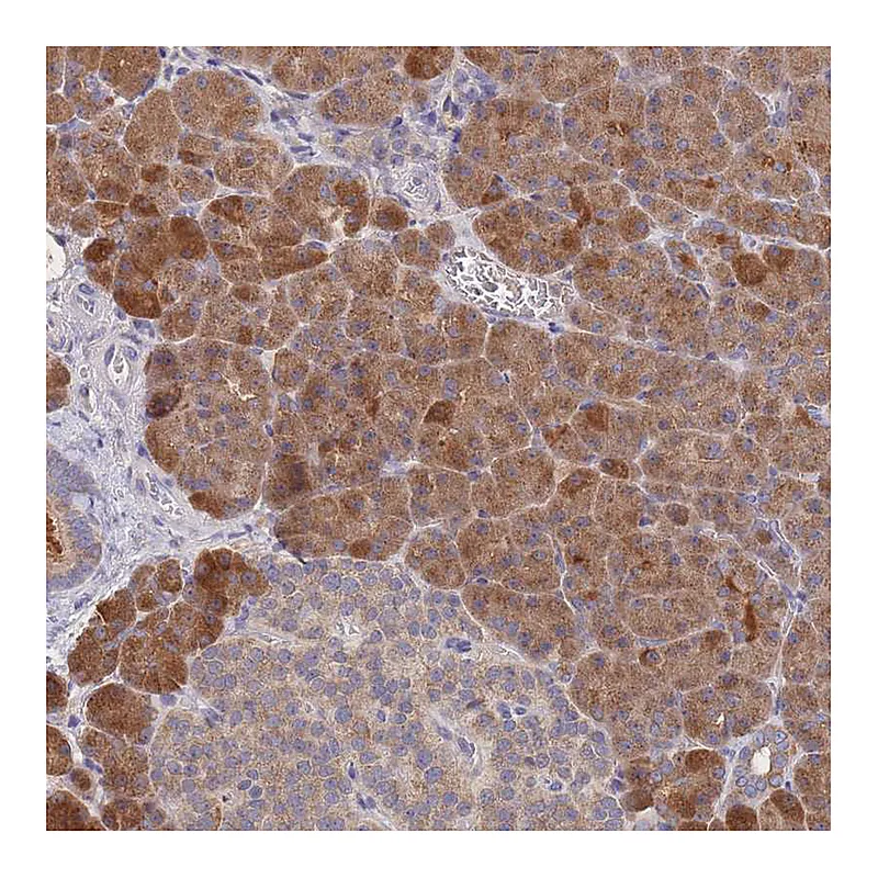 Atlas Antibodies Anti-PPP6C Antibody