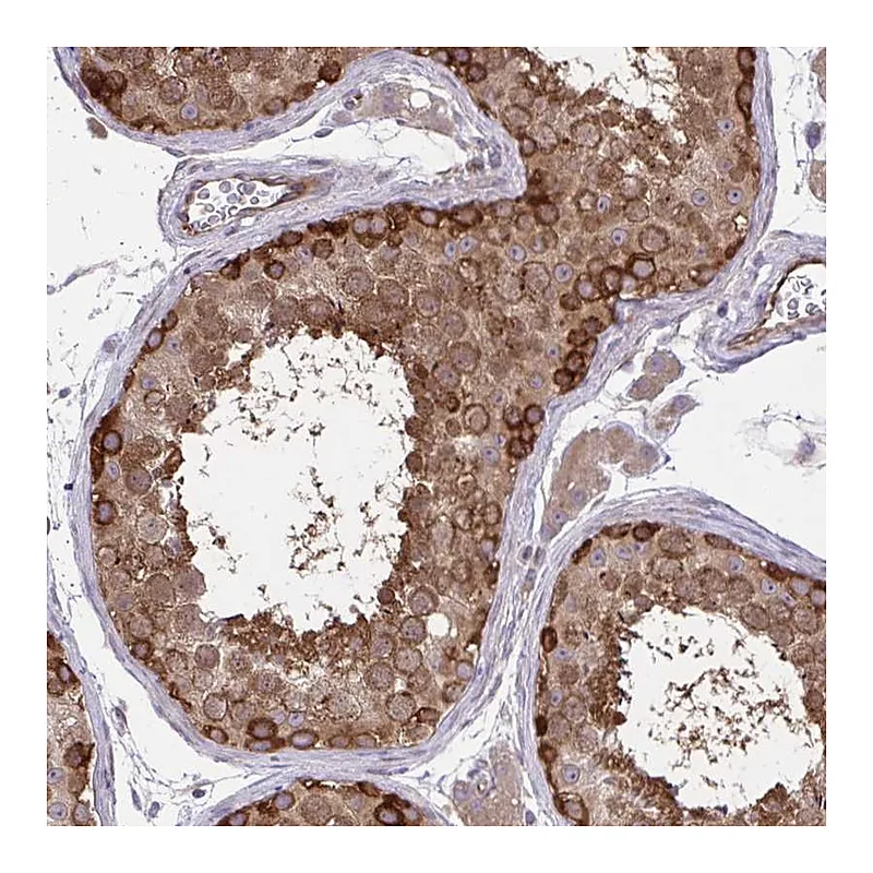Atlas Antibodies Anti-PPP5C Antibody