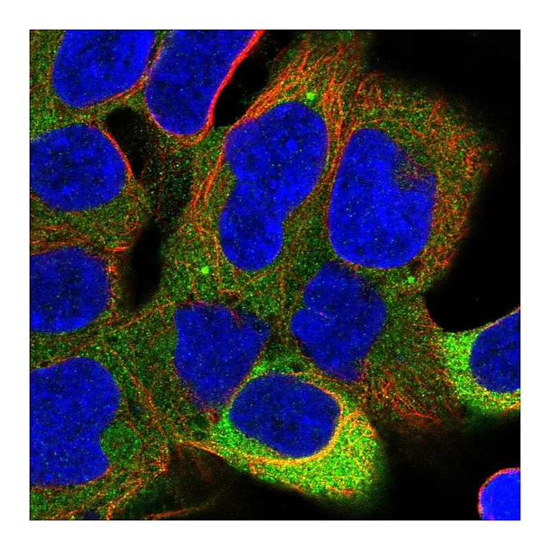 Atlas Antibodies Anti-PPP6R1 Antibody