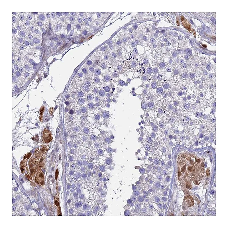 Atlas Antibodies Anti-PPP6R1 Antibody