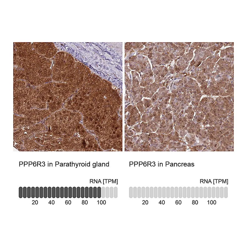 Atlas Antibodies Anti-PPP6R3 Antibody