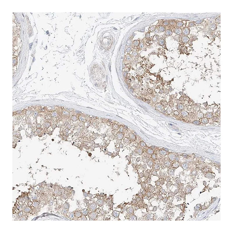 Atlas Antibodies Anti-PPP6R2 Antibody